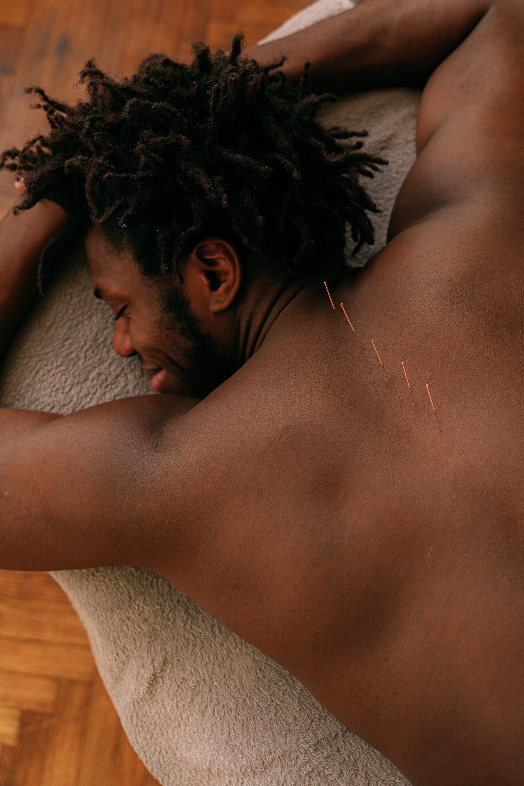 shirtless man laying on his stomach smiling with acupuncture needles in his back